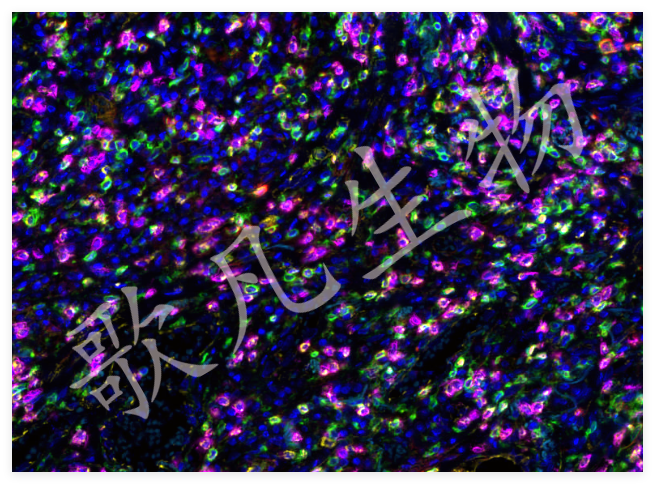 切片扫描（荧光双标 三色）