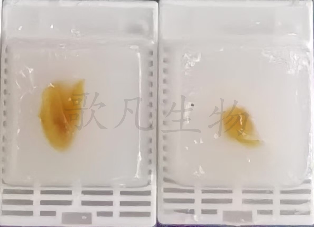 眼球样本石蜡包埋